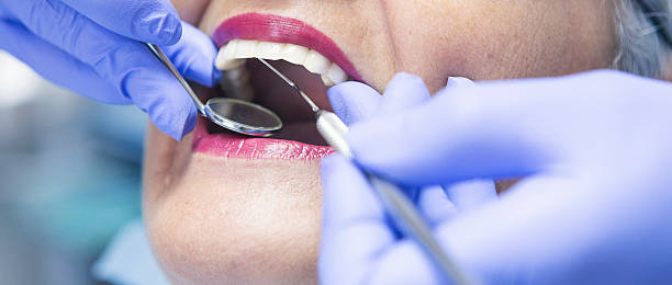 Best Broken or Cracked Tooth Emergency Dentist in Groesbeck, TX